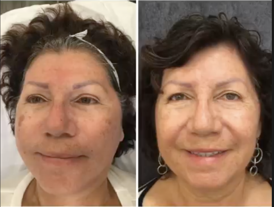 Before treatment - Client 1